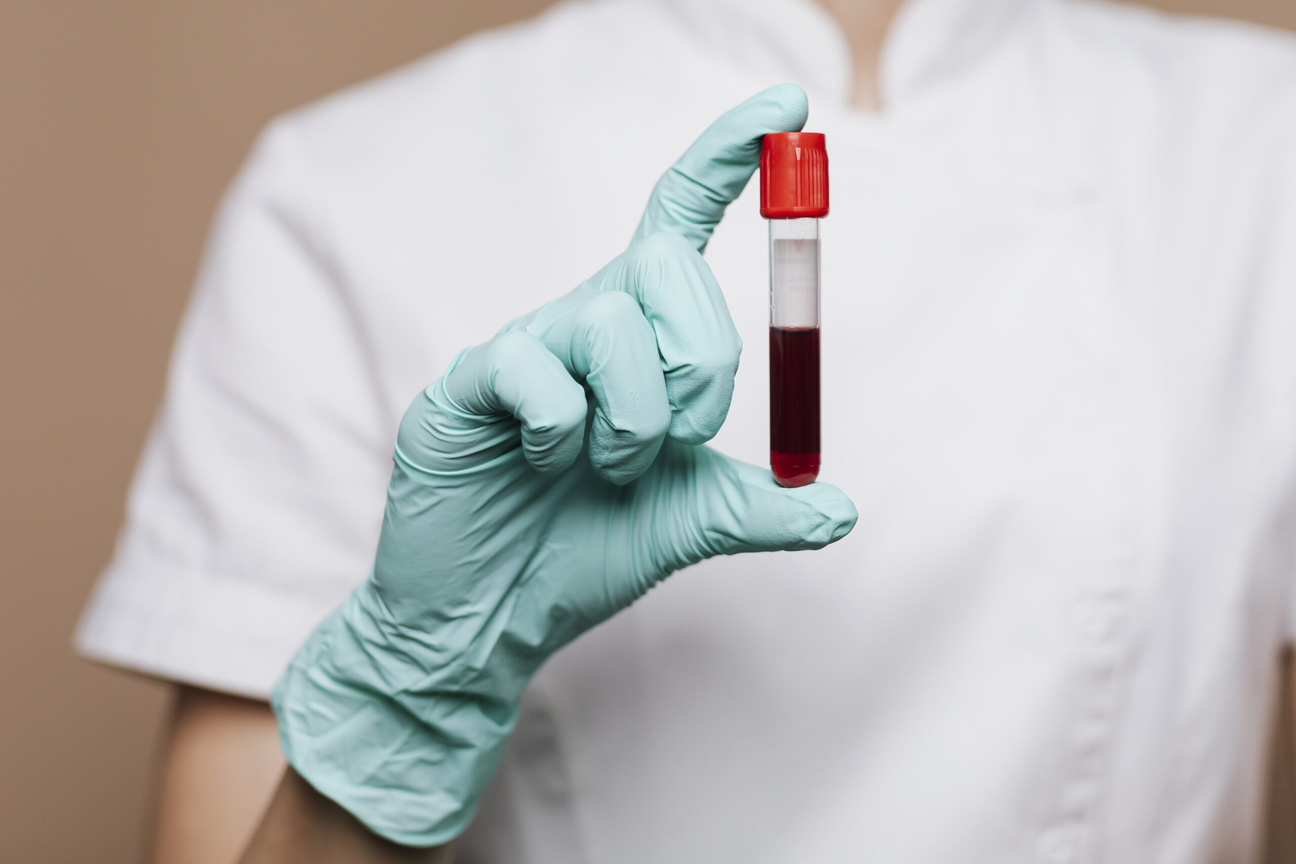The Love Central - Fitness Bloodwork: A New Trend or a Necessity?