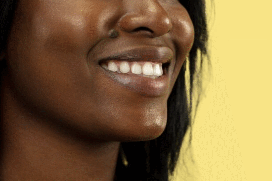 The Power of a Smile: Boosting Mental Health in the Diaspora